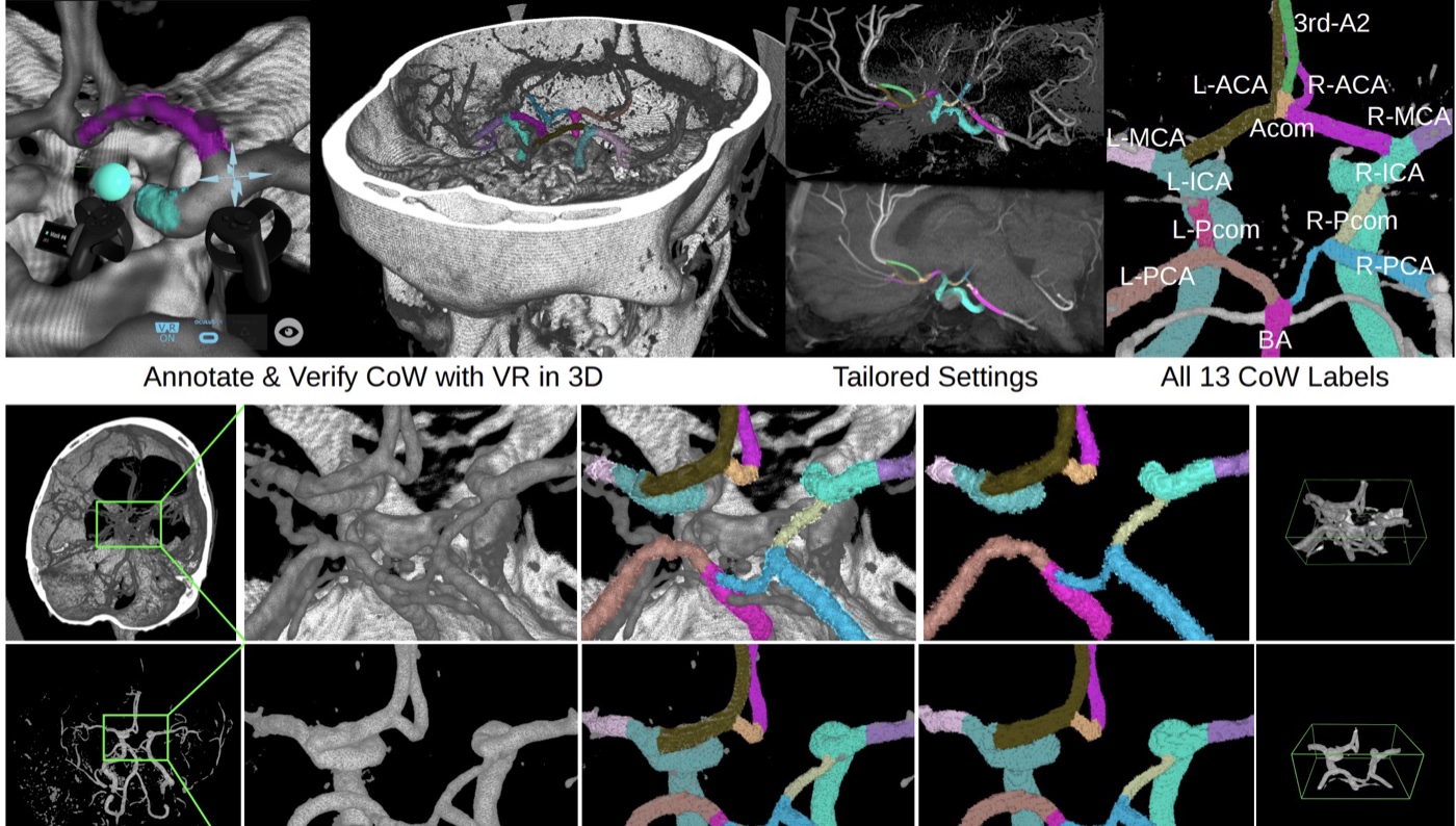 Figure from: Benchmarking the Brain's Blood Vessels - Why We Need Specialized Models in Medical AI